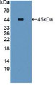 Western Blot; Sample: Recombinant CPA4, Human.