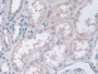 DAB staining on IHC-P; Samples: Human Kidney Tissue.