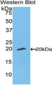 Western Blot; Sample: Recombinant ENPP1, Human.