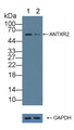 Knockout Varification: &lt;br/&gt;Lane 1: Wild-type PC3 cell lysate; &lt;br/&gt;Lane 2: ANTXR2 knockout PC3 cell lysate; &lt;br/&gt;Predicted MW: 54,53,43,35kd &lt;br/&gt;Observed MW: 58kd&lt;br/&gt;Primary Ab: 1µg/ml Rabbit Anti-Human ANTXR2 Antibody&lt;br/&gt;Second Ab: 0.2µg/mL HRP-Linked Caprine Anti-Rabbit IgG Polyclonal Antibody&lt;br/&gt;