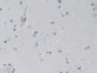 DAB staining on IHC-P; Samples: Human Cerebrum Tissue; Primary Ab: 30µg/ml Rabbit Anti-Human AK3 Antibody Second Ab: 2µg/mL HRP-Linked Caprine Anti-Rabbit IgG Polyclonal Antibody