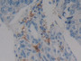 DAB staining on fromalin fixed paraffin- embedded Kidney tissue)