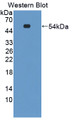 Western Blot; Sample: Recombinant protein.