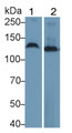 Western Blot; Sample: Recombinant protein.