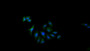 FITC staining on IF; Samples: Human MCF7 cell;  Primary Ab: 20μg/ml Rabbit Anti-Human USP8 Antibody Second Ab: 1.5μg/ml FITC-Linked Caprine Anti-Rabbit IgG Polyclonal Antibody 