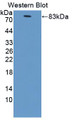 Western Blot; Sample: Recombinant protein.