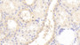 DAB staining on IHC-P; Samples: Human Kidney Tissue; Primary Ab: 20μg/ml Rabbit Anti-Human GNb2 Antibody Second Ab: 2µg/mL HRP-Linked Caprine Anti-Rabbit IgG Polyclonal Antibody