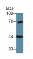 Western Blot; Sample: Rat Cerebrum lysate; Primary Ab: 1µg/ml Rabbit Anti-Human GNa11 Antibody Second Ab: 0.2µg/mL HRP-Linked Caprine Anti-Rabbit IgG Polyclonal Antibody