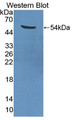 Western Blot; Sample: Recombinant protein.