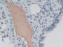 DAB staining on IHC-P;&lt;br/&gt;Samples: Mouse Lung Tissue; &lt;br/&gt;Primary Ab: 30µg/ml Rabbit Anti-Mouse EIF2aK3 Antibody&lt;br/&gt;Second Ab: 2µg/mL HRP-Linked Caprine Anti-Rabbit IgG Polyclonal Antibody&lt;br/&gt;