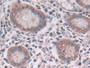 DAB staining on IHC-P; Samples: Human Stomach Tissue; Primary Ab: 30µg/ml Rabbit Anti-Human RNF55 Antibody Second Ab: 2µg/mL HRP-Linked Caprine Anti-Rabbit IgG Polyclonal Antibody