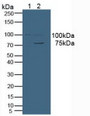 Western Blot; Sample: Lane1: Human Jurkat Cells; Lane2: Human Hela Cells.