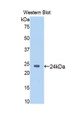 Western Blot; Sample: Recombinant protein.