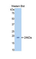 Western Blot; Sample: Recombinant protein.