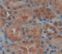 Sirtuin 5 (Sirt5) Polyclonal Antibody, Cat#CAU22617