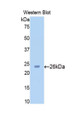 Western Blot; Sample: Recombinant protein.