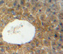 DAB staining on fromalin fixed paraffin-embedded liver tissue)
