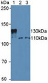 Western Blot; Sample: Lane1: Mouse Serum; Lane2: Human Jurkat Cells; Lane3: Human Hela Cells.