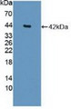 Western Blot; Sample: Recombinant HDAC9, Human.