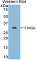 Western Blot; Sample: Recombinant protein.