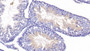 DAB staining on IHC-P; Samples: Mouse Testis Tissue; Primary Ab: 20µg/ml Rabbit Anti-Mouse HDAC6 Antibody Second Ab: 2µg/mL HRP-Linked Caprine Anti-Rabbit IgG Polyclonal Antibody