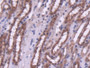 DAB staining on IHC-P; Samples: Mouse Kidney Tissue;  Primary Ab: 20µg/ml Rabbit Anti-Mouse HDAC4 An