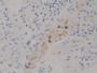 DAB staining on IHC-P; Samples: Human Stomach Tissue;  Primary Ab: 10µg/ml Rabbit Anti-Human DGKz An