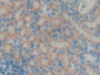 DAB staining on IHC-P; Samples: Rat Kidney Tissue; Primary Ab: 10µg/ml Rabbit Anti-Rat DGKg Antibody Second Ab: 2µg/mL HRP-Linked Caprine Anti-Rabbit IgG Polyclonal Antibody