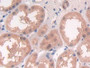 DAB staining on IHC-P; Samples: Human Kidney Tissue; Primary Ab: 30µg/ml Rabbit Anti-Human DGKe Antibody Second Ab: 2µg/mL HRP-Linked Caprine Anti-Rabbit IgG Polyclonal Antibody