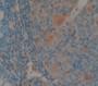 Interleukin 1 Epsilon (Il1E) Polyclonal Antibody, Cat#CAU22648