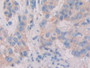 DAB staining on fromalin fixed paraffin-embedded Intestine tissue)