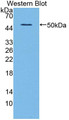 Western Blot; Sample: Recombinant protein.