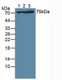 Western Blot; Sample: Lane1: Human U-87MG Cells; Lane2: Porcine Brain Tissue; Lane3: Mouse Brain Tissue.