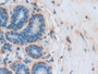 DAB staining on fromalin fixed paraffin- embedded liver tissue)