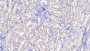 DAB staining on IHC-P; Samples: Human Kidney Tissue;  Primary Ab: 20μg/ml Rabbit Anti-Human ANXA3 Antibody Second Ab: 2µg/mL HRP-Linked Caprine Anti-Rabbit IgG Polyclonal Antibody 