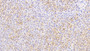 DAB staining on IHC-P; Samples: Human Liver Tissue; Primary Ab: 20μg/ml Rabbit Anti-Human ANXA9 Antibody Second Ab: 2µg/mL HRP-Linked Caprine Anti-Rabbit IgG Polyclonal Antibody