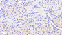 DAB staining on fromalin fixed paraffin- embedded skin tissue)