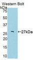 Western Blot; Sample: Recombinant protein.