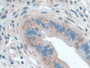 DAB staining on fromalin fixed paraffin-embedded Lung tissue)