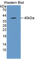 Western Blot; Sample: Recombinant protein.