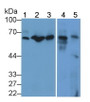 Western Blot; Sample: Lane1: K562 cell lysate; Lane2: Rat Spleen lysate; Lane3: Rat Kidney lysate; Lane4: Mouse Spleen lysate; Lane5: Mouse Kidney lysate; Primary Ab: 5μg/ml Rabbit Anti-Human IL22R Antibody; Second Ab: 0.2µg/mL HRP-Linked Caprine Anti-Rabbit IgG Polyclonal Antibody;