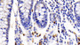 DAB staining on IHC-P; Sample: Human Colon Tissue; Primary Ab: 20ug/ml Rabbit Anti-Human IL22R Antibody Second Ab: 2µg/mL HRP-Linked Caprine Anti-Rabbit IgG Polyclonal Antibody