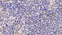 DAB staining on IHC-P. Samples: Human Tissue)