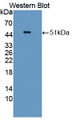 Western Blot; Sample: Recombinant protein.