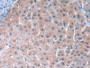 DAB staining on IHC-P; Samples: Human Liver Tissue)