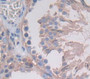 Used in DAB staining on fromalin fixed paraffin- embedded Kidney tissue