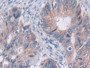 DAB staining on fromalin fixed paraffin- embedded Kidney tissue)