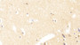 DAB staining on IHC-P; Samples: Human Cerebrum Tissue;  Primary Ab: 20μg/ml Rabbit Anti-Human TUBb1 Antibody Second Ab: 2µg/mL HRP-Linked Caprine Anti-Rabbit IgG Polyclonal Antibody 