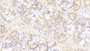 DAB staining on IHC-P; Samples: Human Stomach Tissue; Primary Ab: 20μg/ml Rabbit Anti-Human SPHK1 Antibody Second Ab: 2µg/mL HRP-Linked Caprine Anti-Rabbit IgG Polyclonal Antibody
