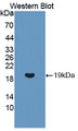 Western Blot; Sample: Recombinant protein.